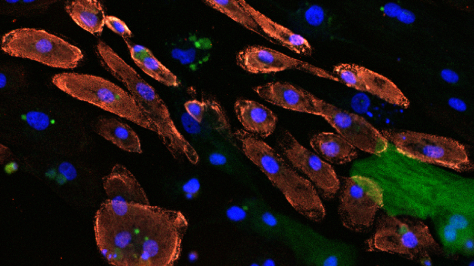 Microscope image of cells stained with red blue and green.